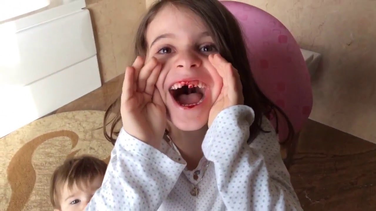 pulling out teeth videos